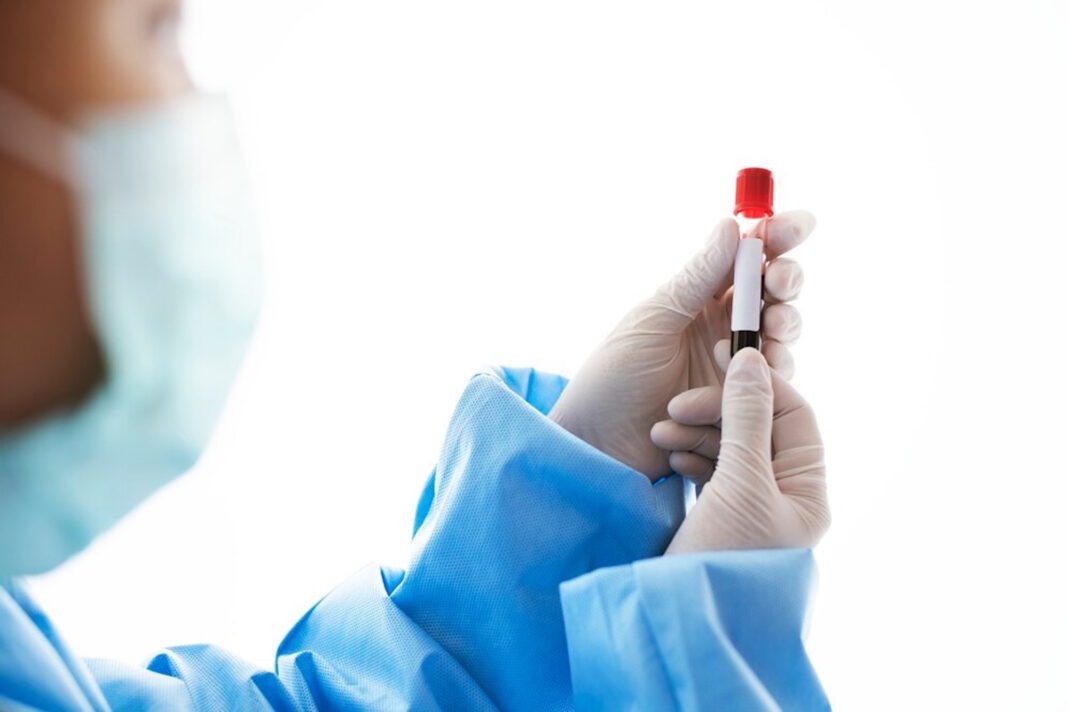 doctor-holding-blood-test-tube