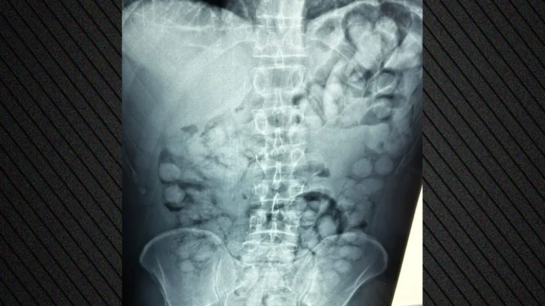 arthrou-narkwntika2 (1)